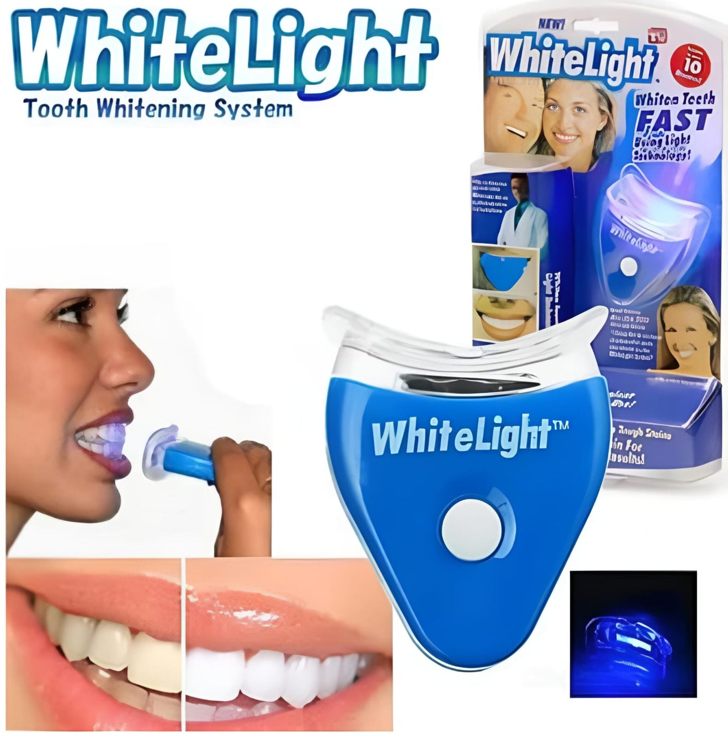 White Light Tooth Whitening System